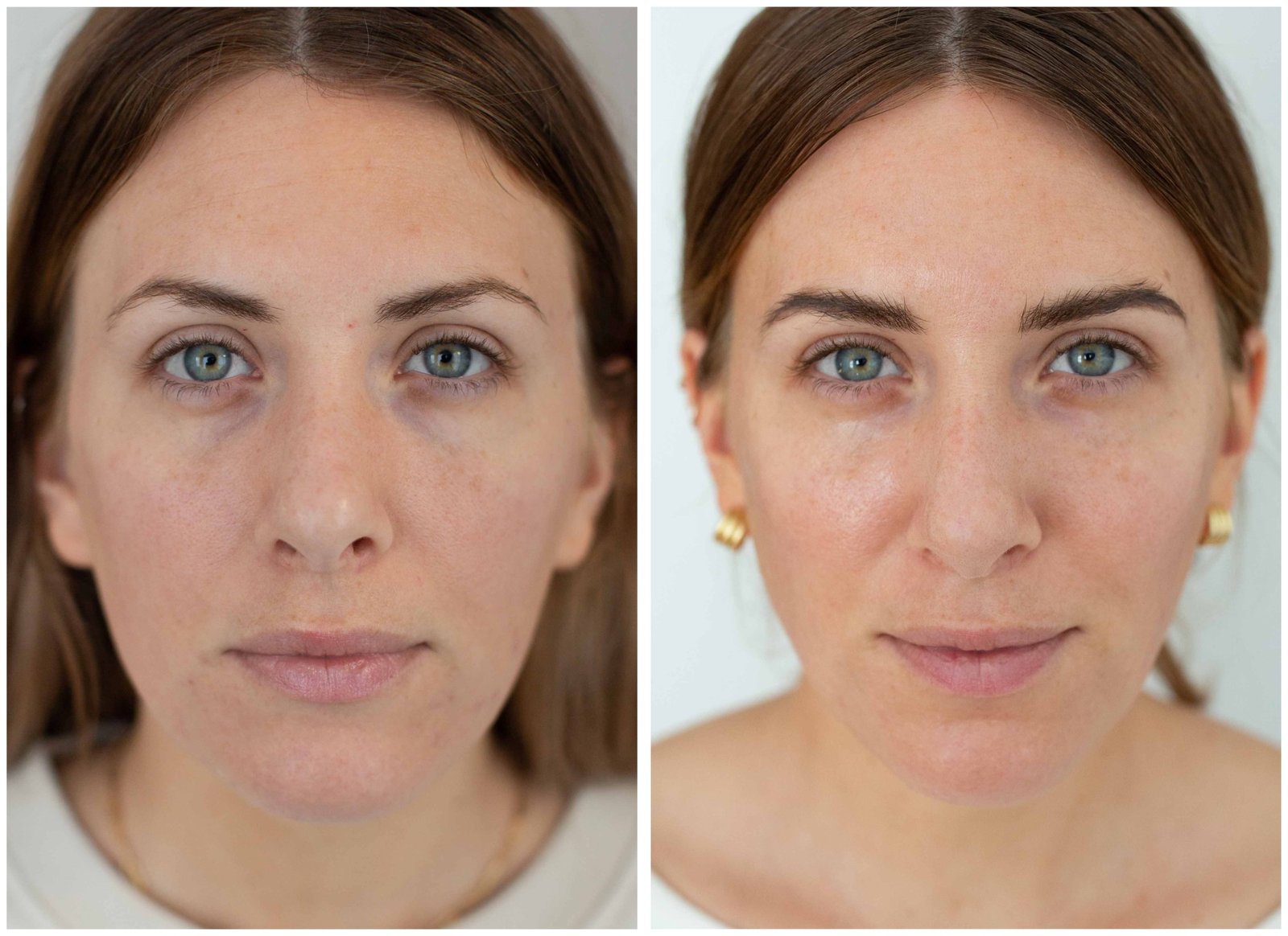 Before and After result E